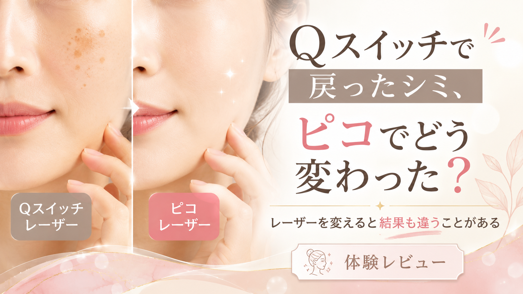 湘南「シミ取りレーザー10」体験談｜痛みやダウンタイム、効果を徹底レポ